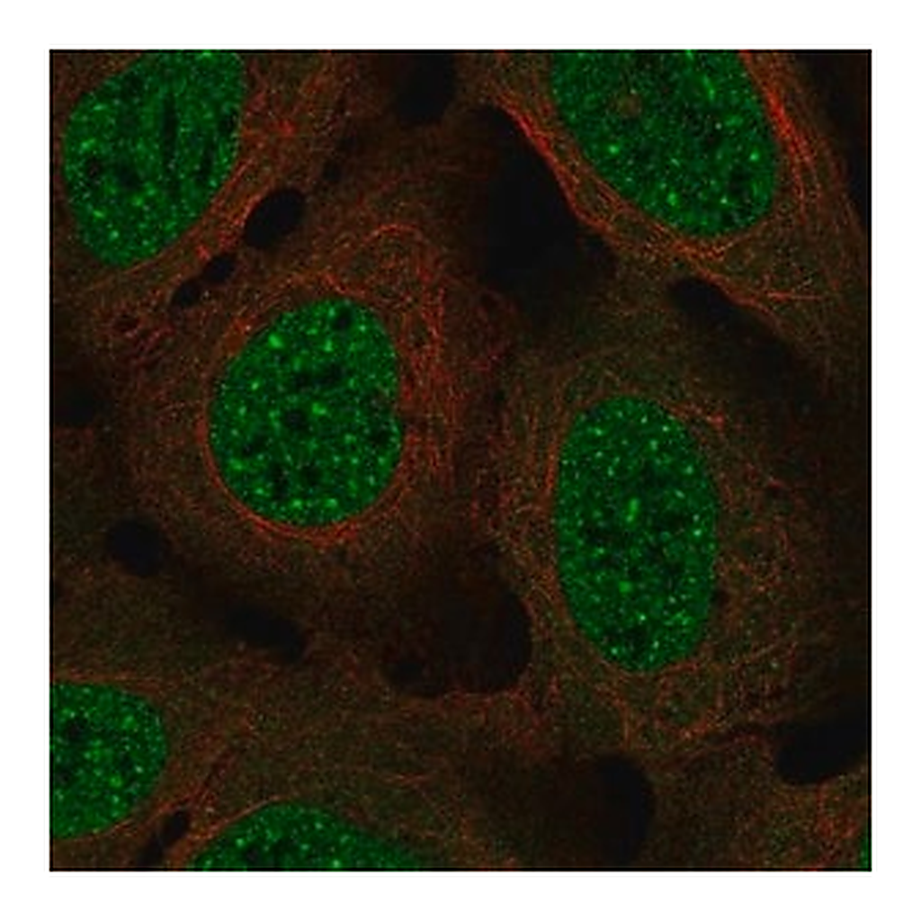 Merck Anti-NDC80 antibody produced in rabbit