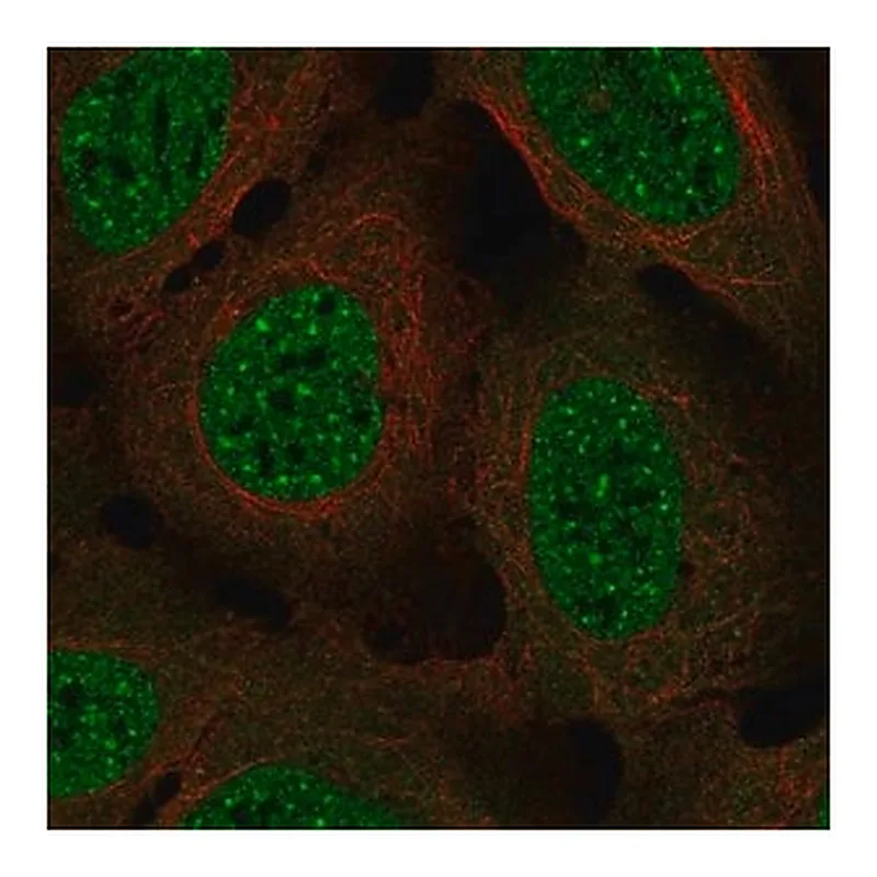 Merck Anti-NDC80 antibody produced in rabbit
