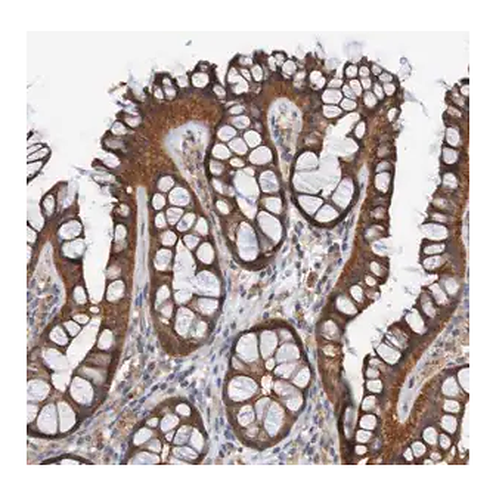 Merck Anti-ST8SIA6 antibody produced in rabbit