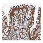 Merck Anti-ST8SIA6 antibody produced in rabbit