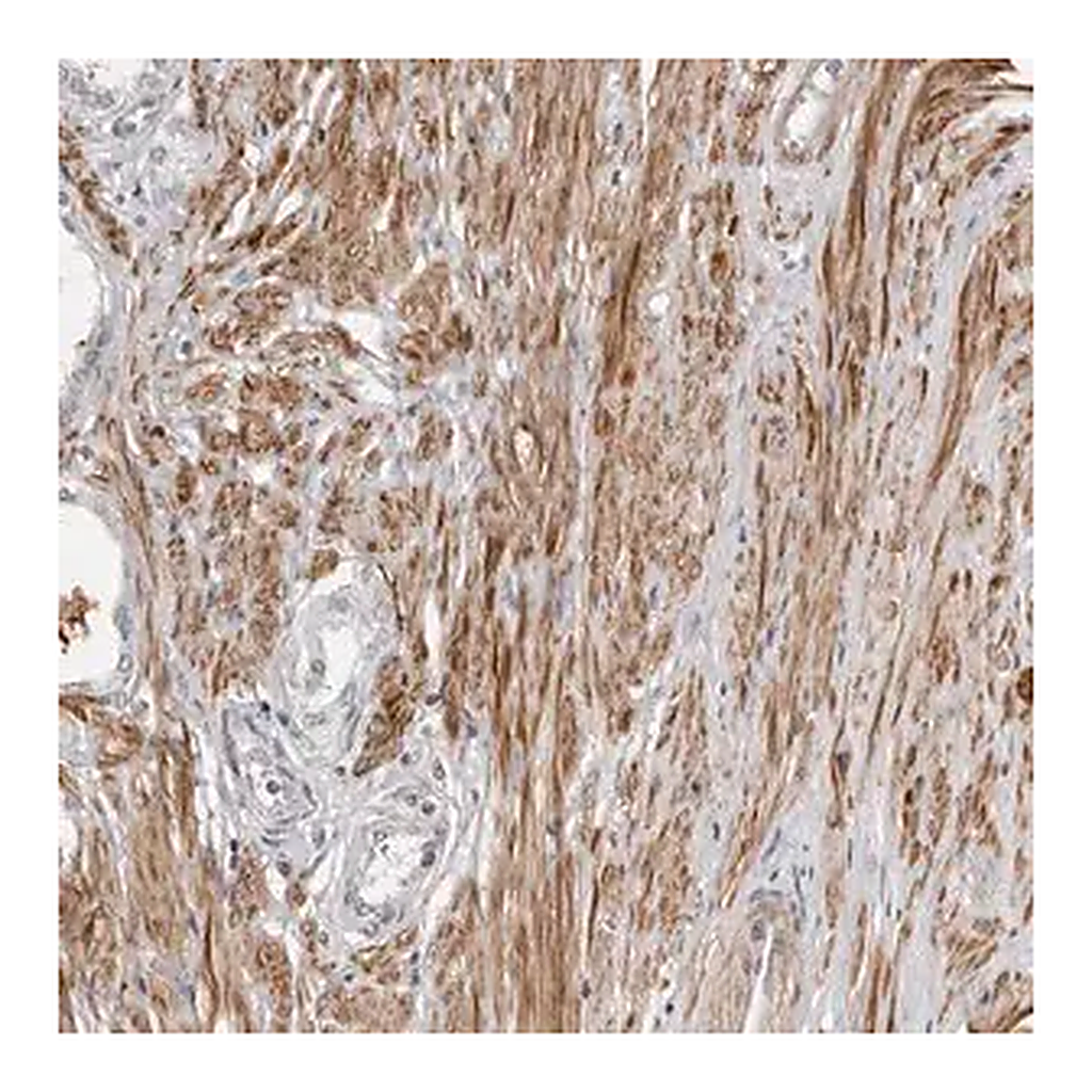 Merck Anti-UNK antibody produced in rabbit