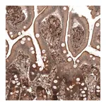 Merck Anti-IL17RE antibody produced in rabbit