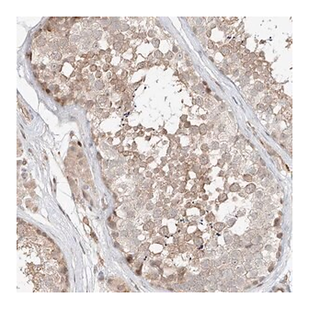 Merck Anti-CEP162 antibody produced in rabbit