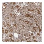 Merck Anti-EXOSC10 antibody produced in rabbit