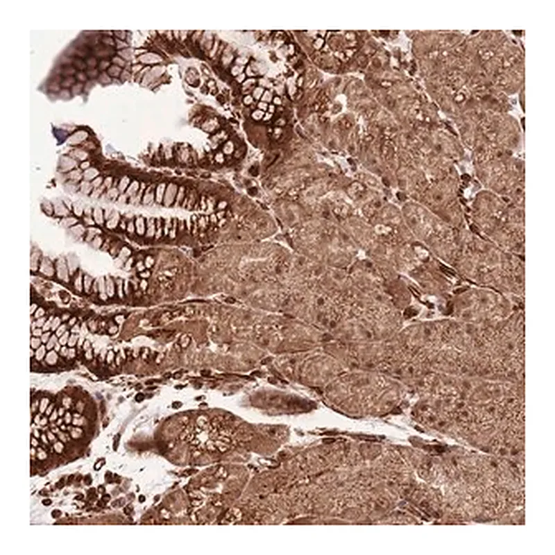 Merck Anti-ADAMTS3 antibody produced in rabbit