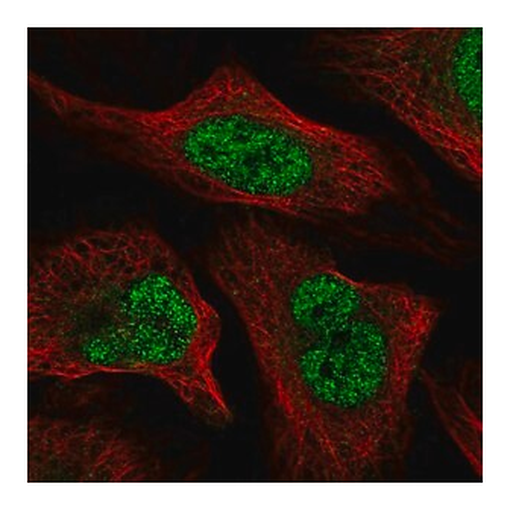 Merck Anti-WAC antibody produced in rabbit