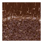 Merck Anti-IGLON5 antibody produced in rabbit