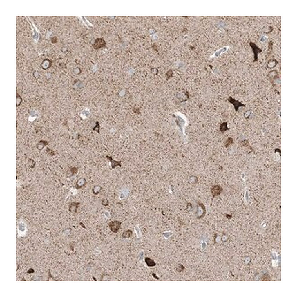Merck Anti-RPP40 antibody produced in rabbit