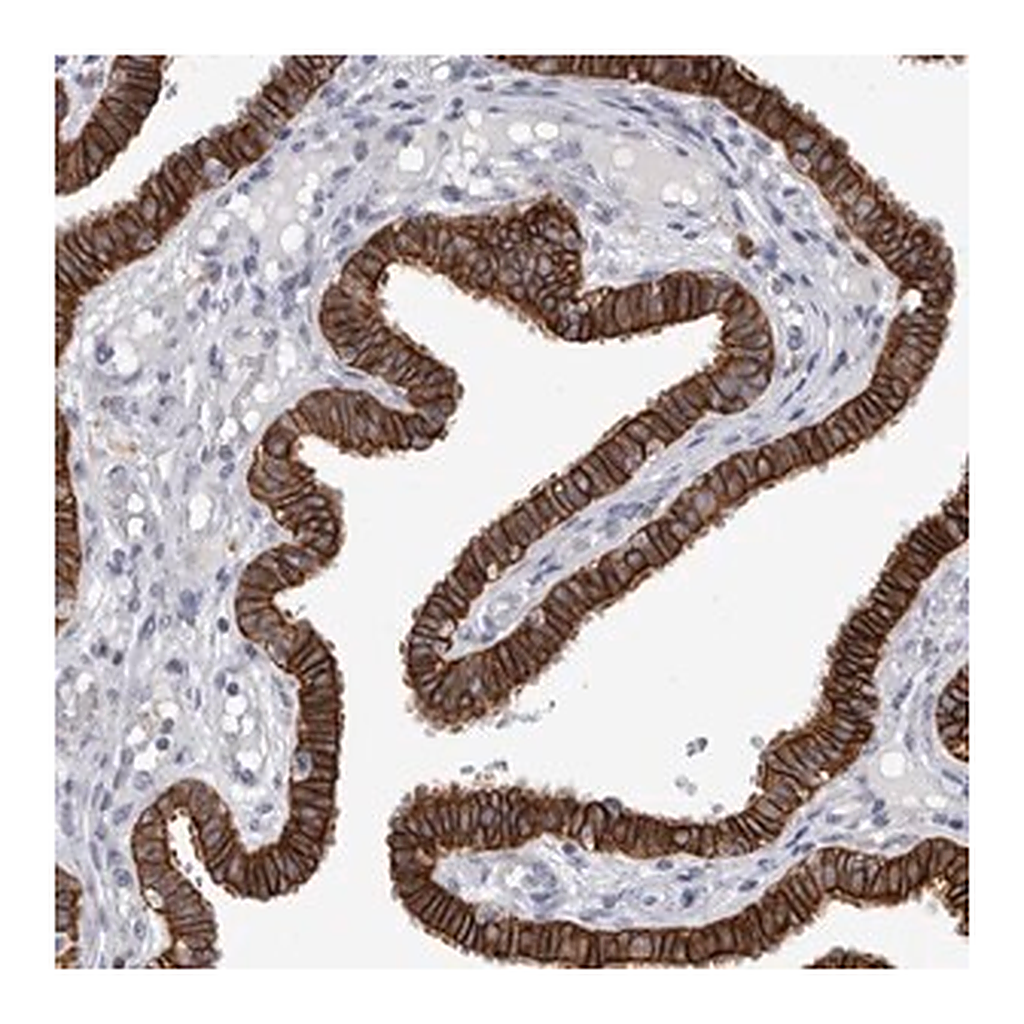 Merck Anti-SLC20A2 antibody produced in rabbit