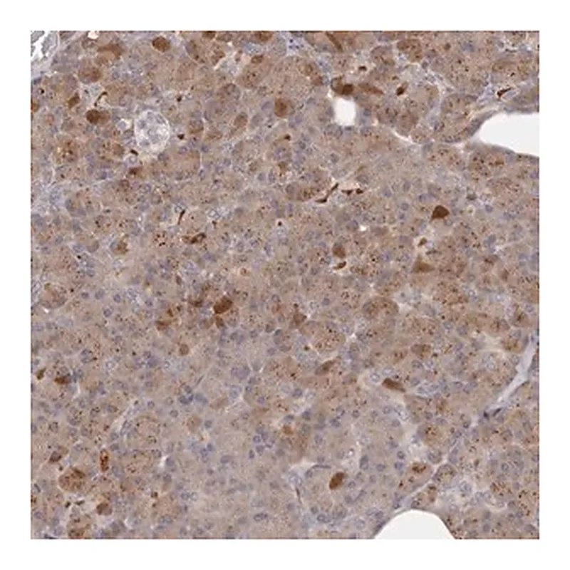 Merck Anti-ANKRD44 antibody produced in rabbit