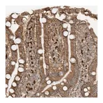 Merck Anti-SDCCAG3 antibody produced in rabbit