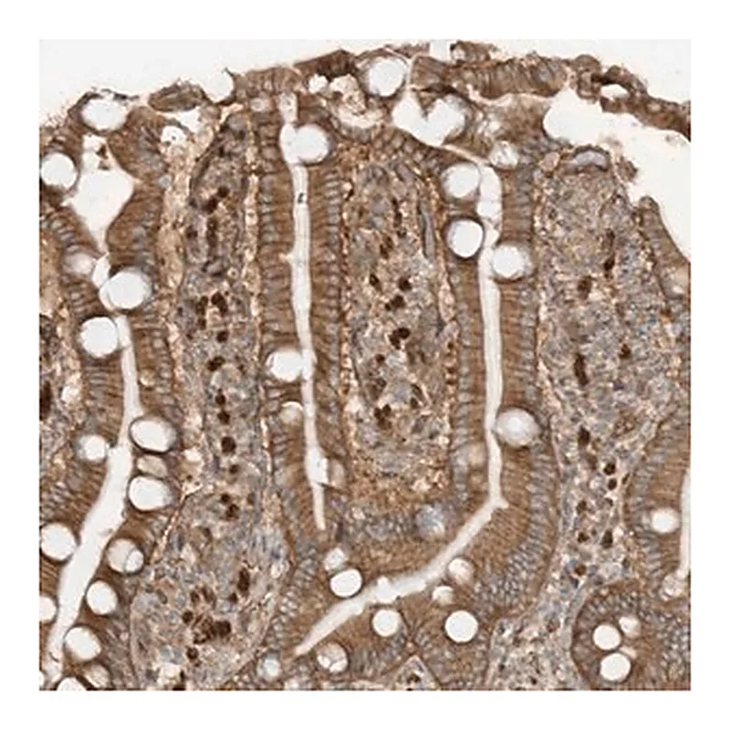Merck Anti-SDCCAG3 antibody produced in rabbit