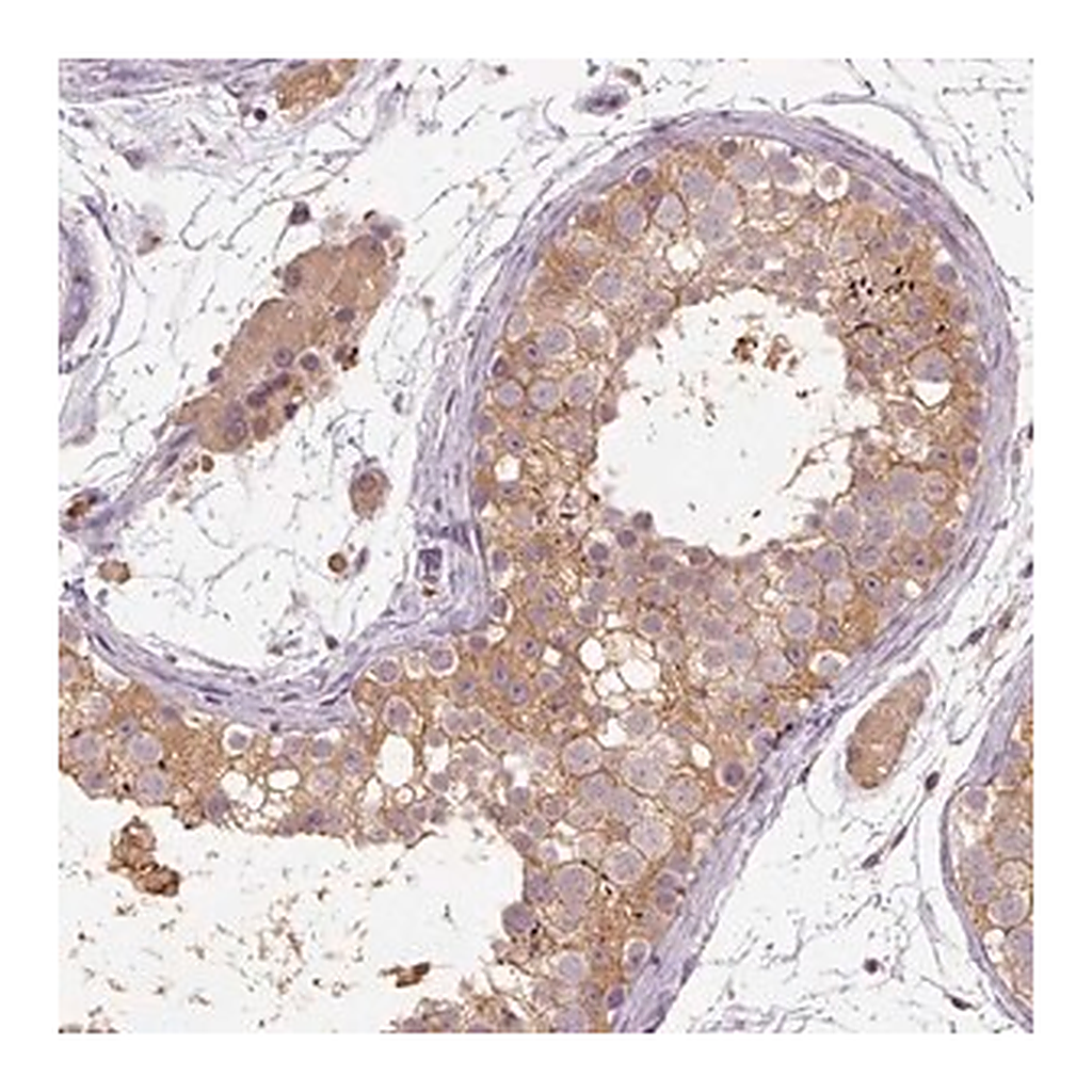 Merck Anti-CFAP65 antibody produced in rabbit