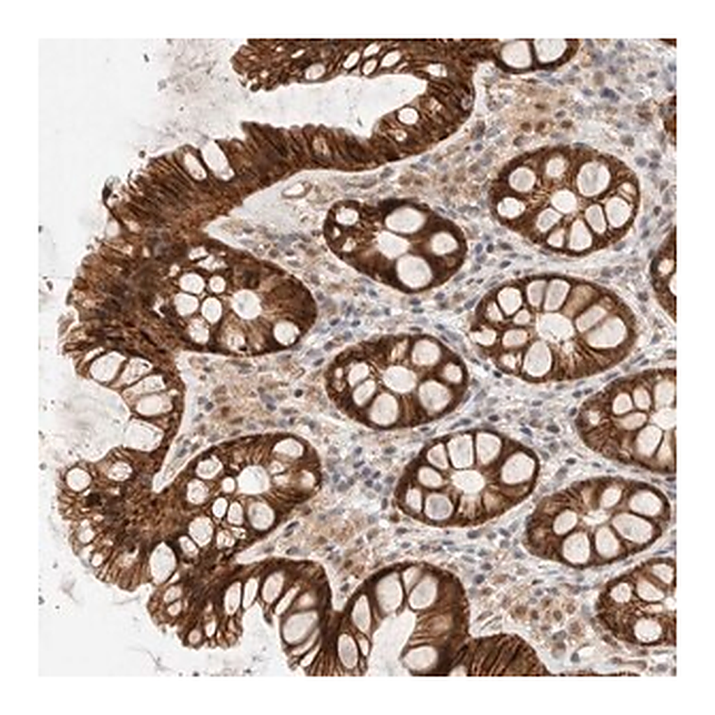 Merck Anti-AK8 antibody produced in rabbit