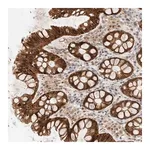 Merck Anti-AK8 antibody produced in rabbit