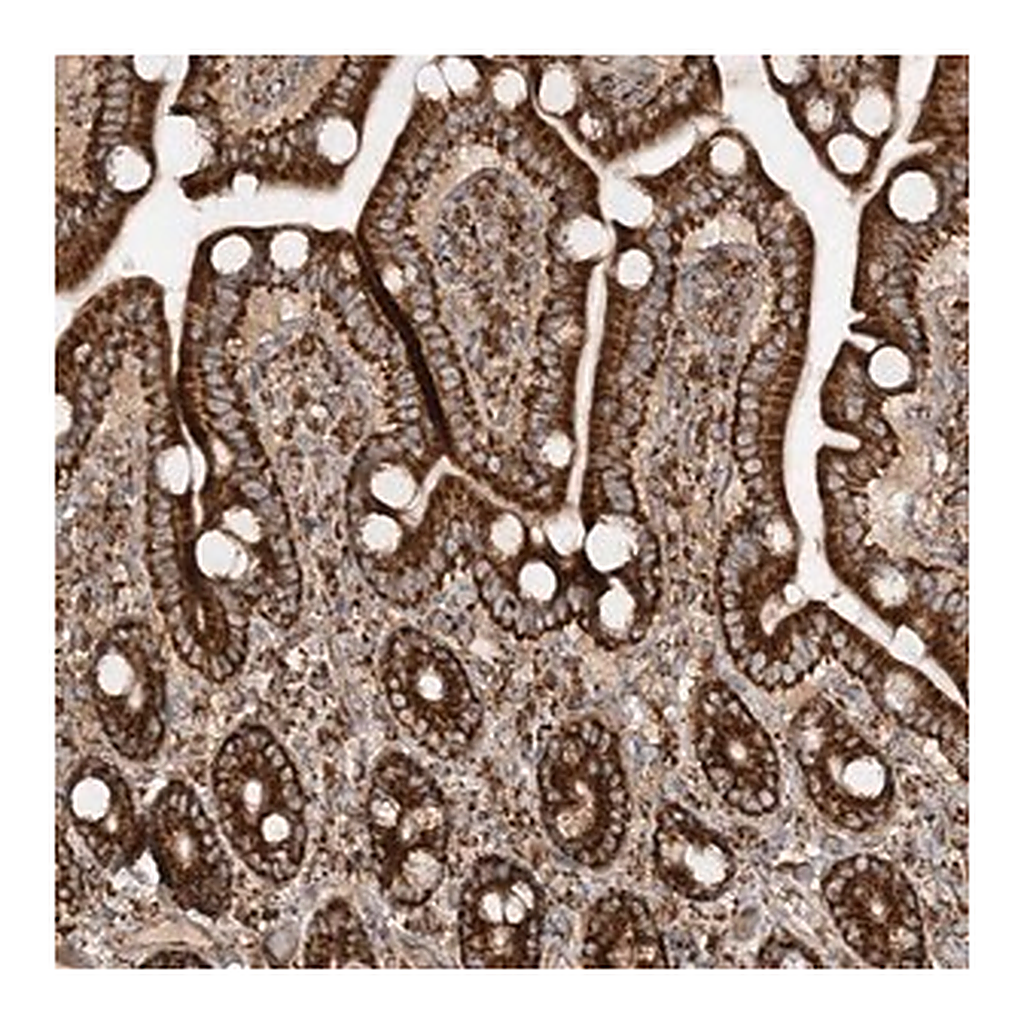 Merck Anti-AARS2 antibody produced in rabbit