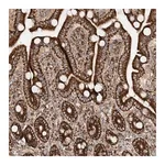 Merck Anti-AARS2 antibody produced in rabbit
