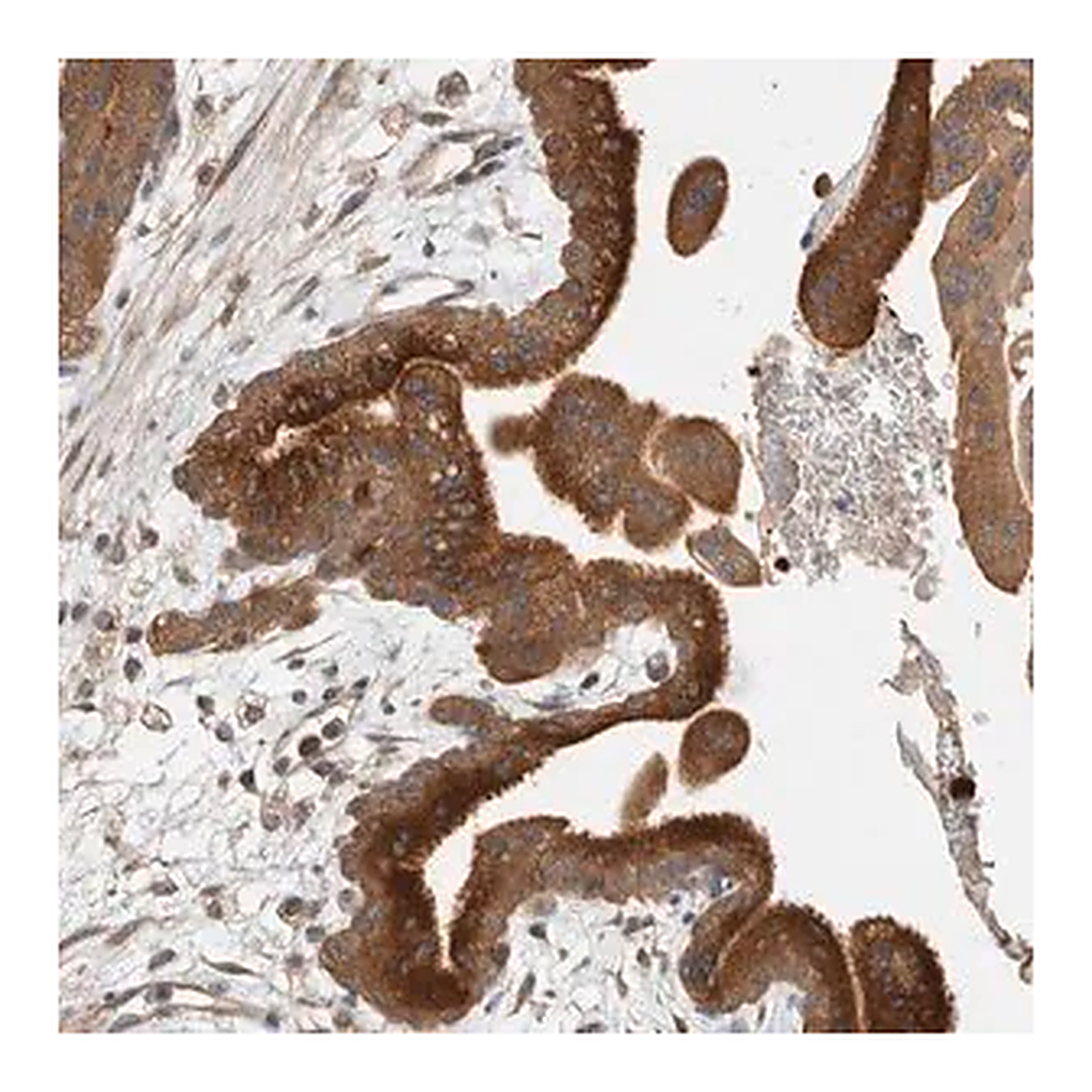 Merck Anti-CLIP1 antibody produced in rabbit
