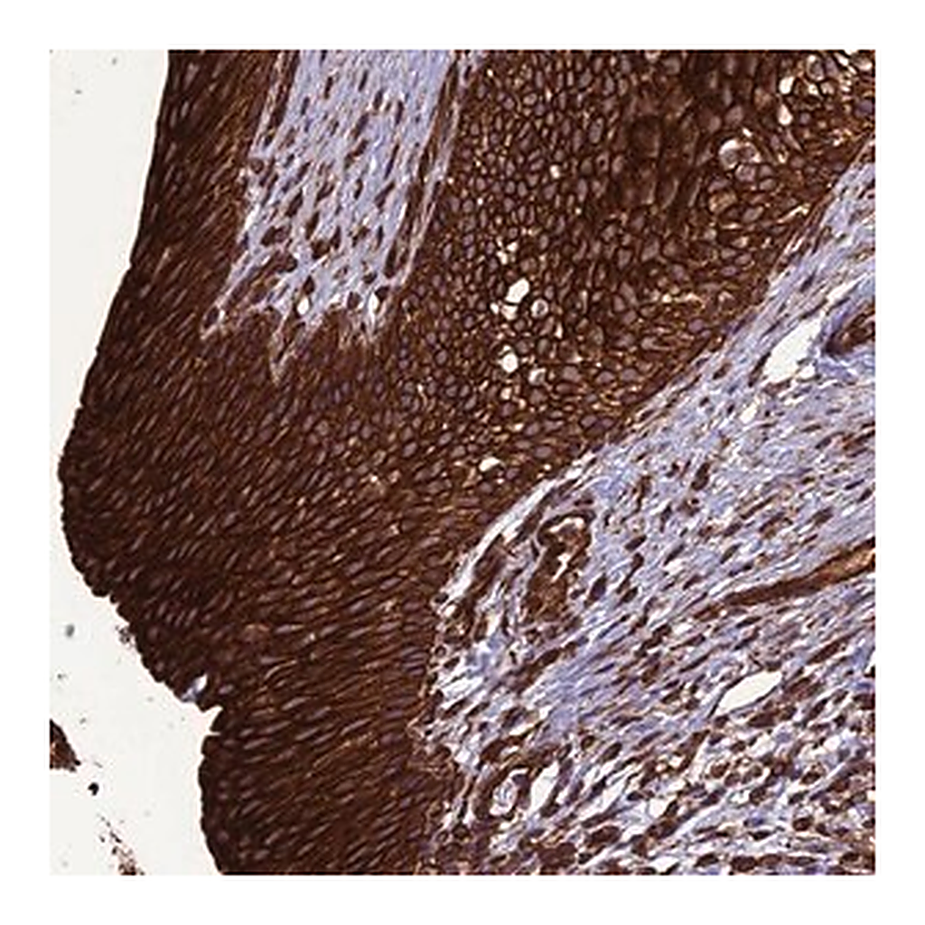 Merck Anti-BICDL2 antibody produced in rabbit