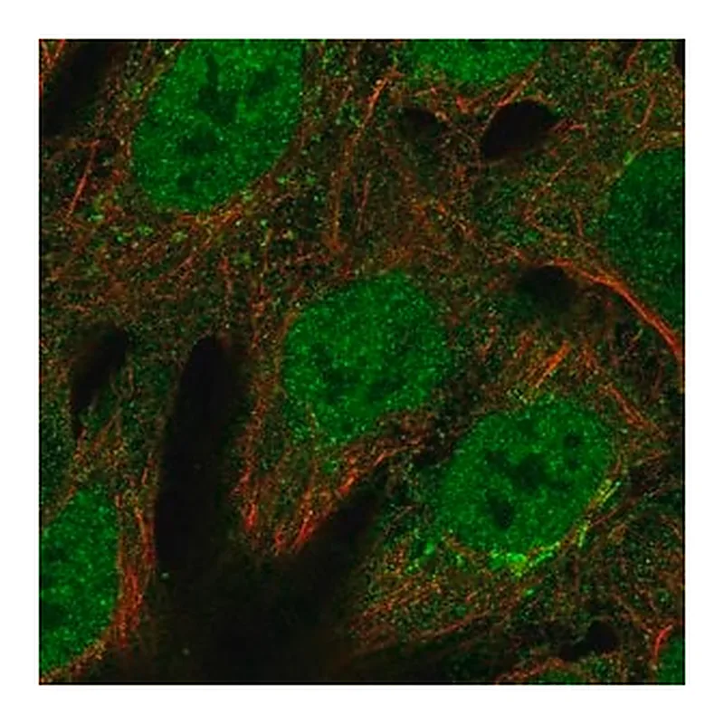 Merck Anti-BCL6 antibody produced in rabbit