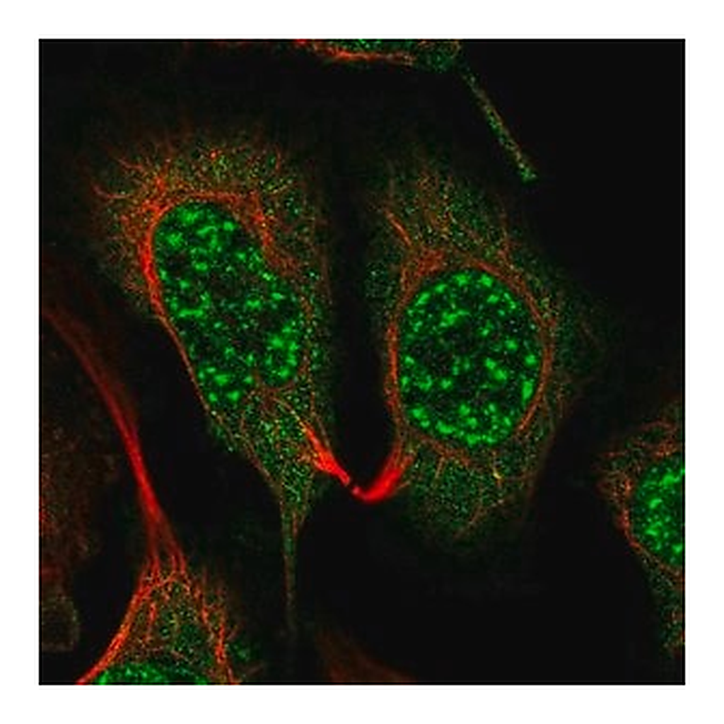 Merck Anti-GNB5 antibody produced in rabbit