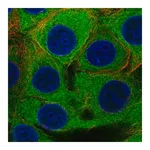 Merck Anti-PFKP antibody produced in rabbit