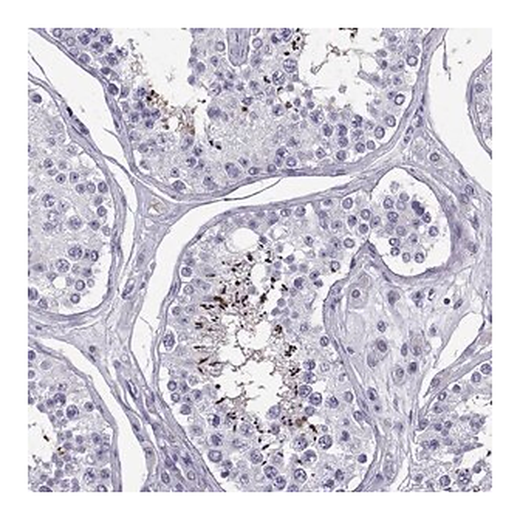 Merck Anti-PGK2 antibody produced in rabbit