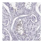 Merck Anti-PGK2 antibody produced in rabbit