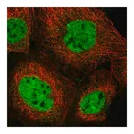 Merck Anti-NCOA6 antibody produced in rabbit