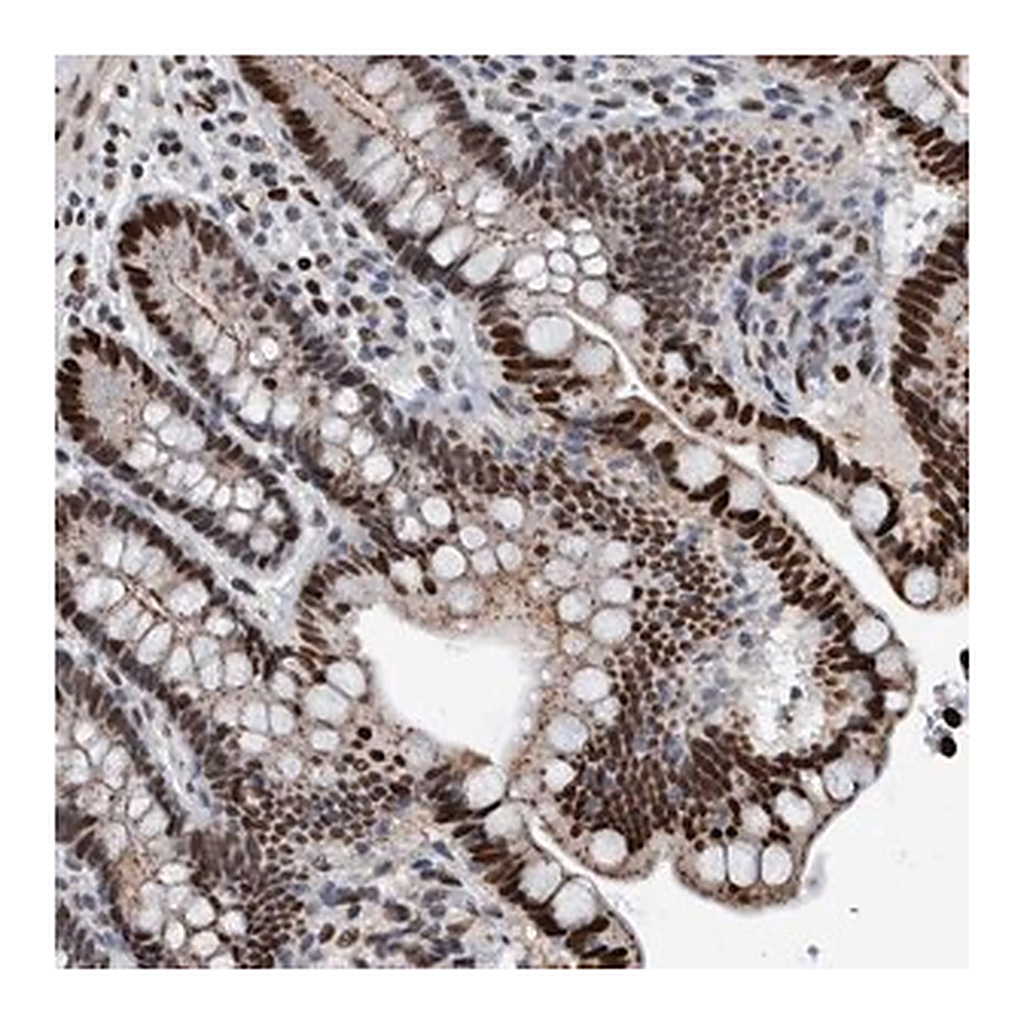 Merck Anti-HEATR9 antibody produced in rabbit