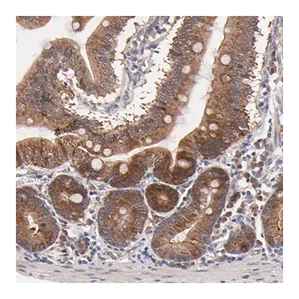 Merck Anti-BAIAP2L2 antibody produced in rabbit