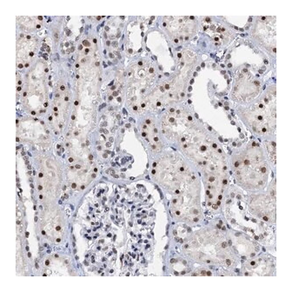 Merck Anti-SNRPD1 antibody produced in rabbit