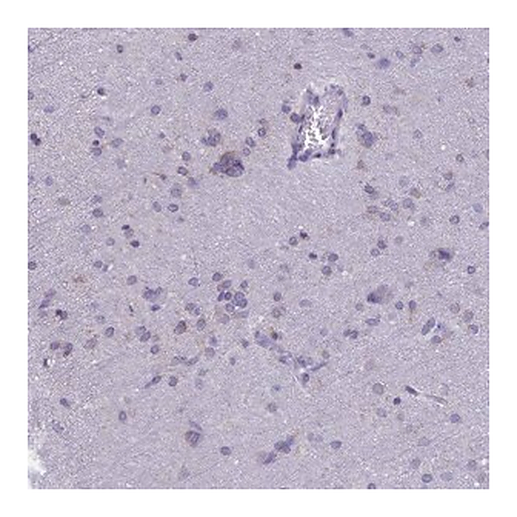 Merck Anti-TMEM206 antibody produced in rabbit