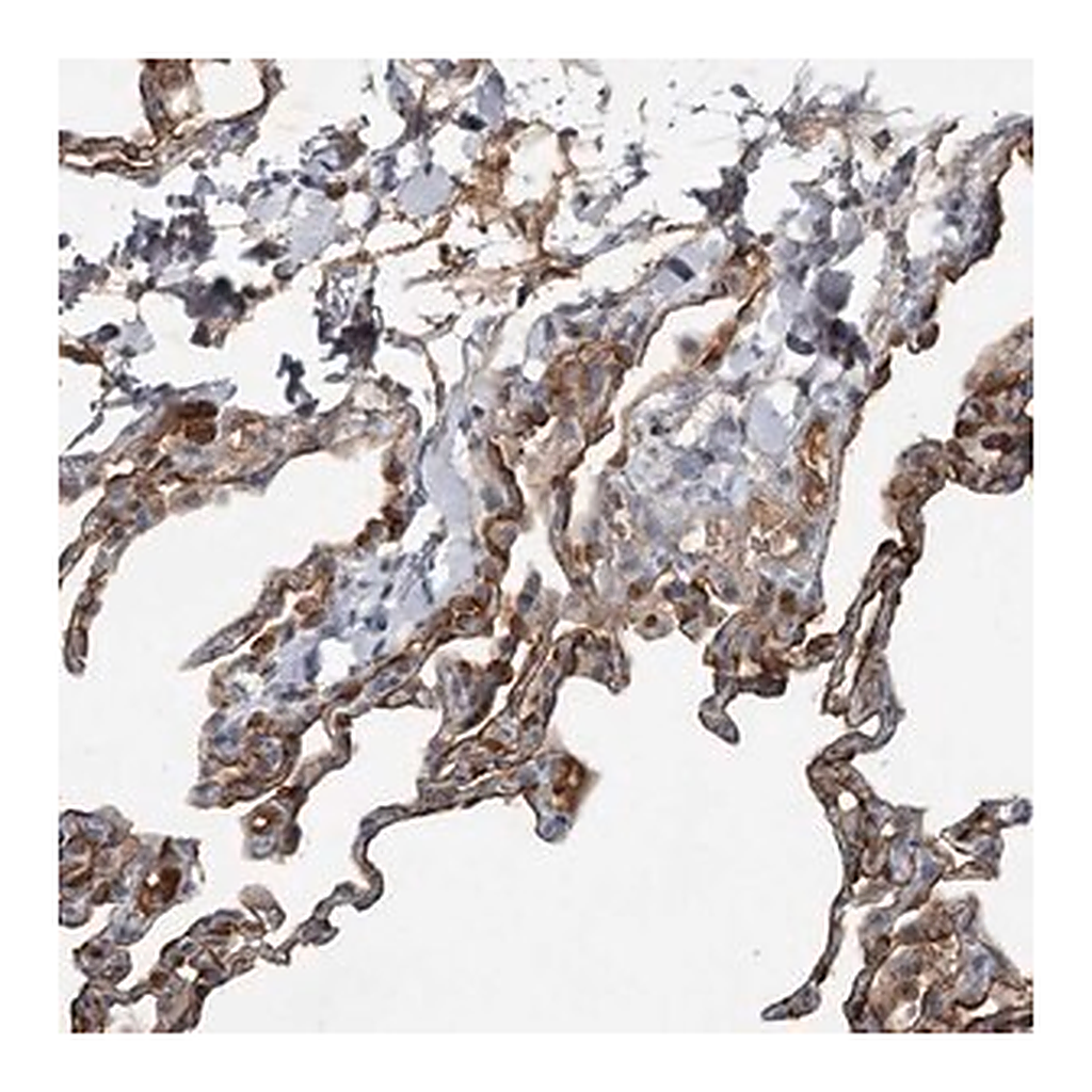Merck Anti-SLC39A8 antibody produced in rabbit