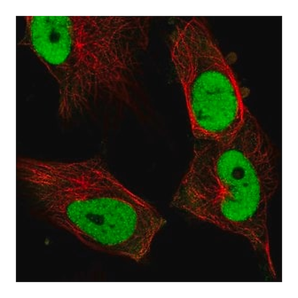Merck Anti-FOSL1 antibody produced in rabbit