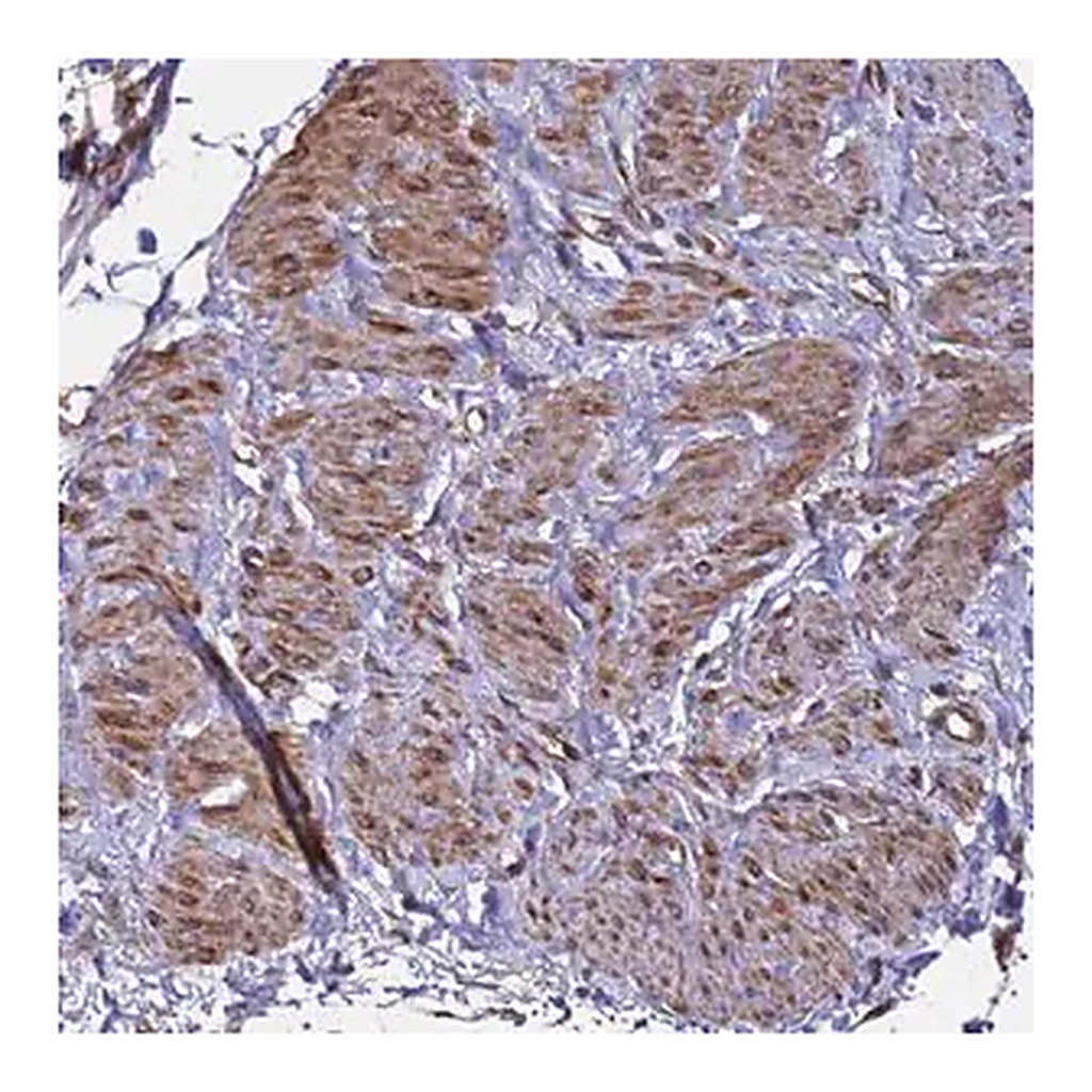 Merck Anti-MOCS1 antibody produced in rabbit
