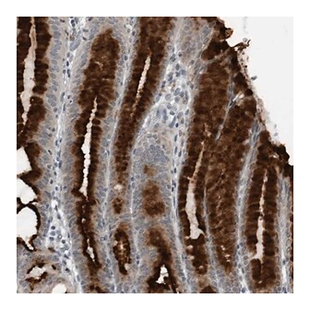 Merck Anti-GAK antibody produced in rabbit