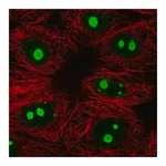 Merck Anti-KNOP1 antibody produced in rabbit