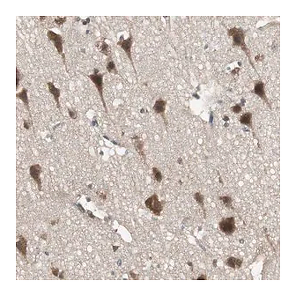 Merck Anti-PFDN1 antibody produced in rabbit