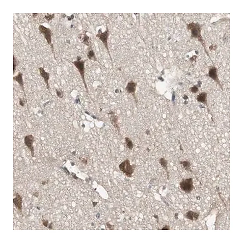 Merck Anti-PFDN1 antibody produced in rabbit