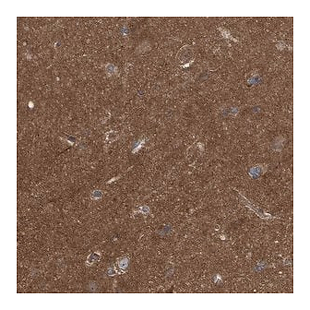 Merck Anti-LRSAM1 antibody produced in rabbit