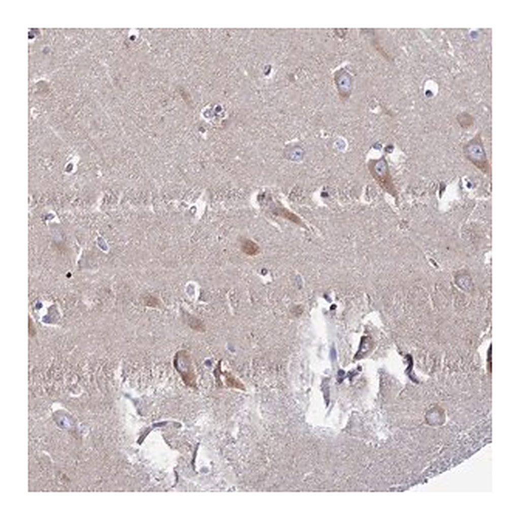 Merck Anti-CLCN3 antibody produced in rabbit