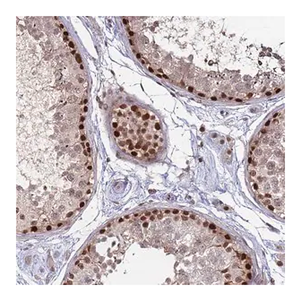 Merck Anti-TRMT6 antibody produced in rabbit