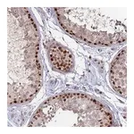 Merck Anti-TRMT6 antibody produced in rabbit