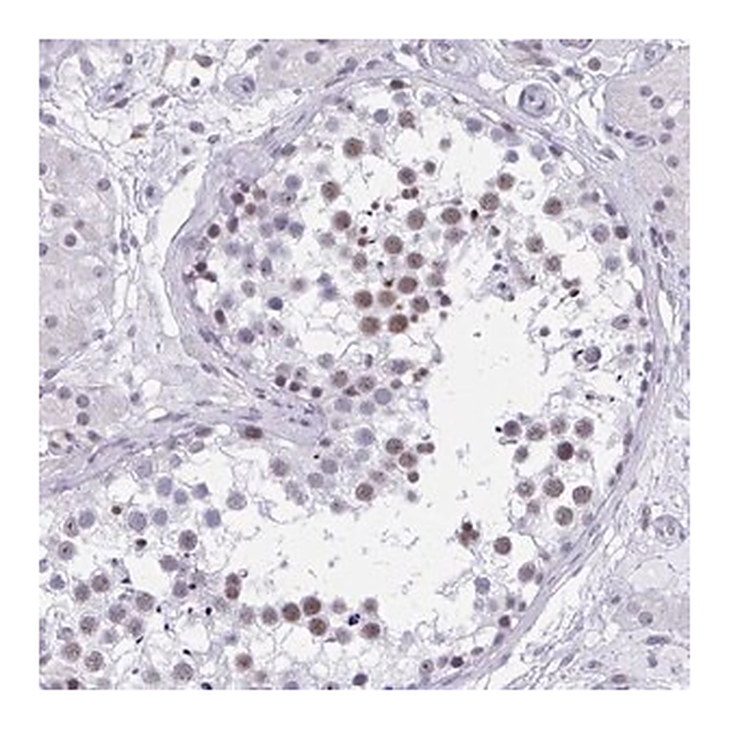 Merck Anti-CCDC105 antibody produced in rabbit