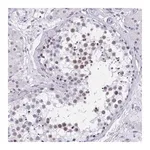 Merck Anti-CCDC105 antibody produced in rabbit