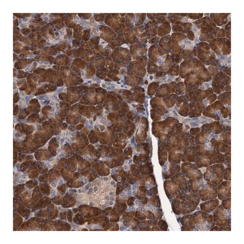 Merck Anti-RGS11 antibody produced in rabbit