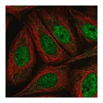 Merck Anti-AKIP1 antibody produced in rabbit