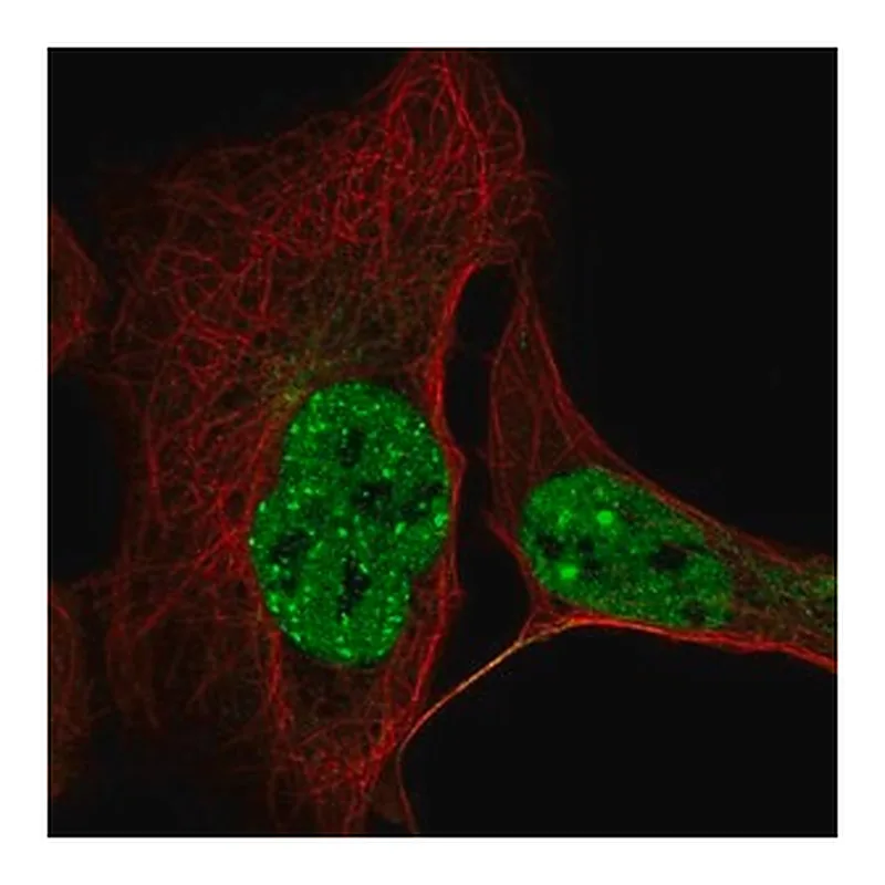Merck Anti-CCDC188 antibody produced in rabbit
