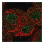 Merck Anti-CHD8 antibody produced in rabbit